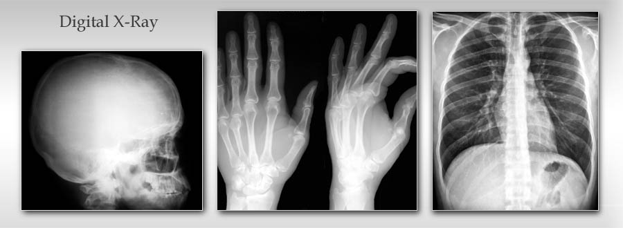 StandUp MRI of the Bronx